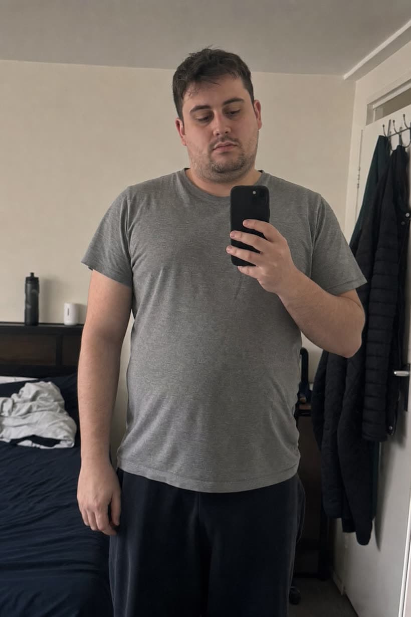 Before — AI weight loss visualization